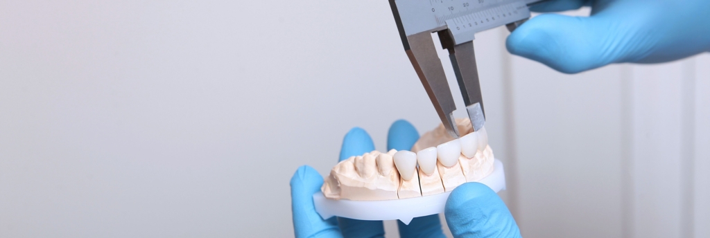 Composite Bonding: Your Questions Answered
