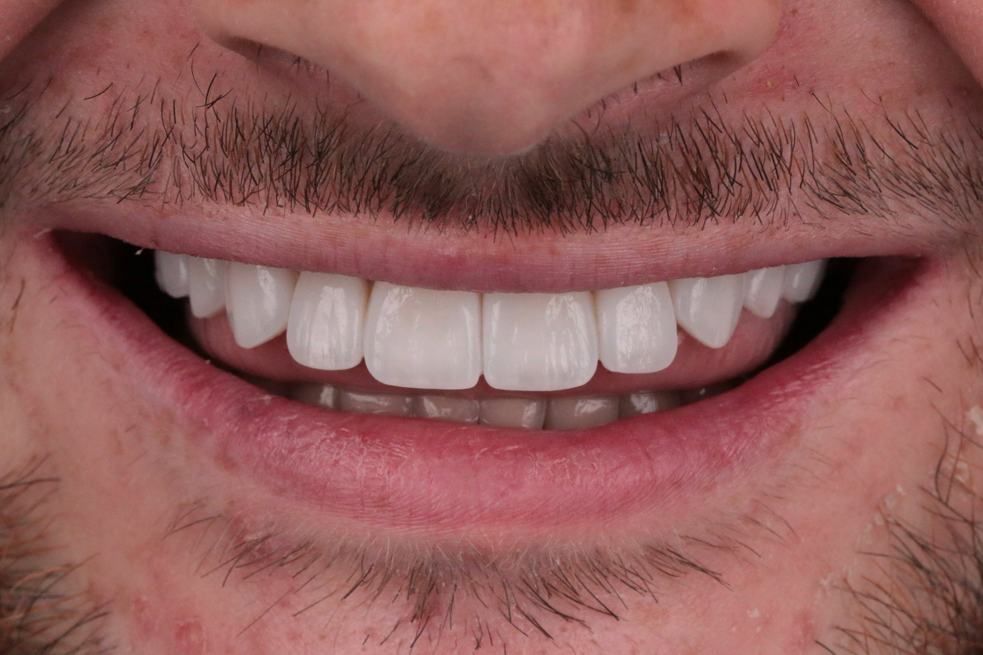 PPC Composite 1
