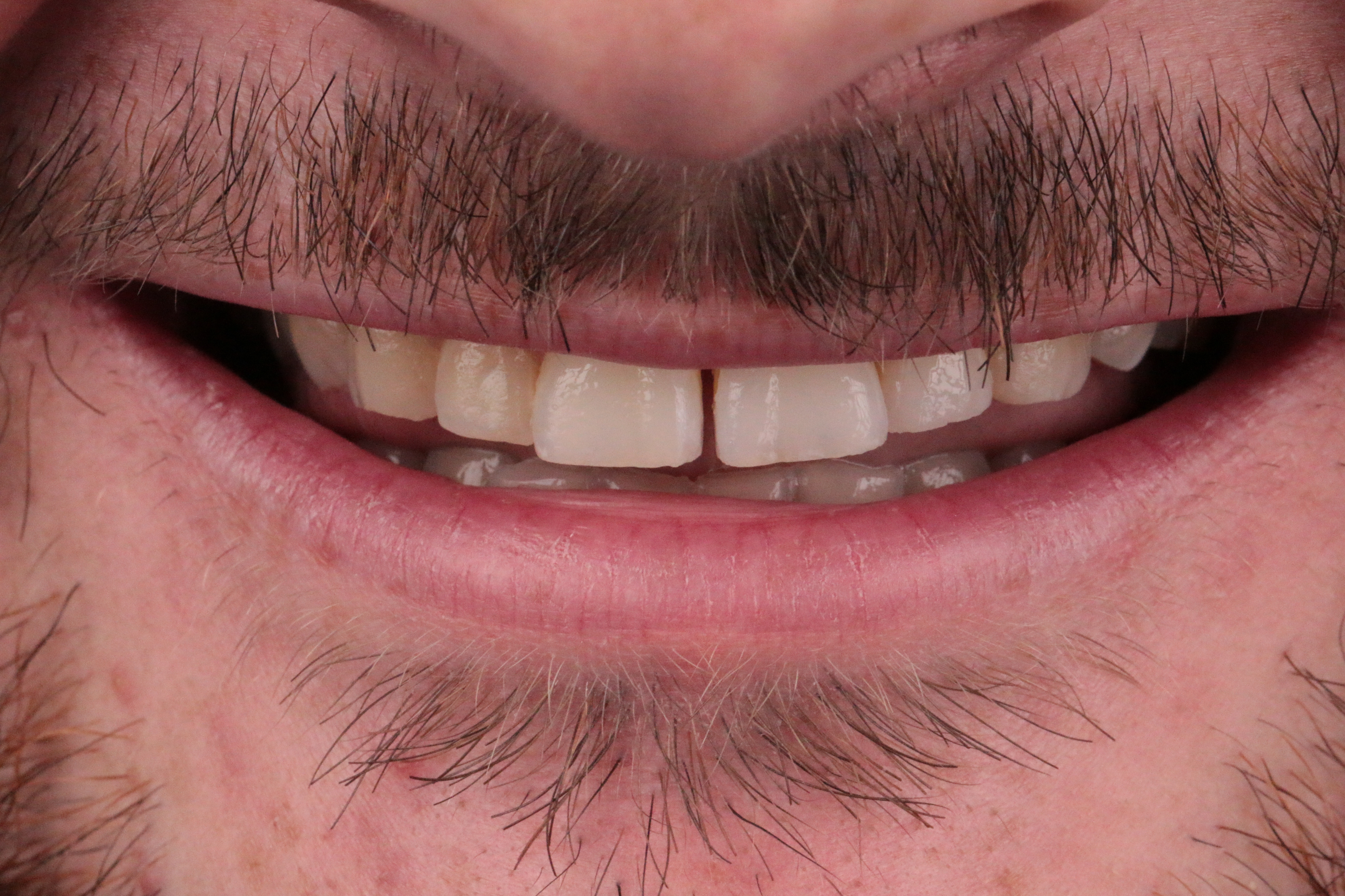 PPC Composite 1