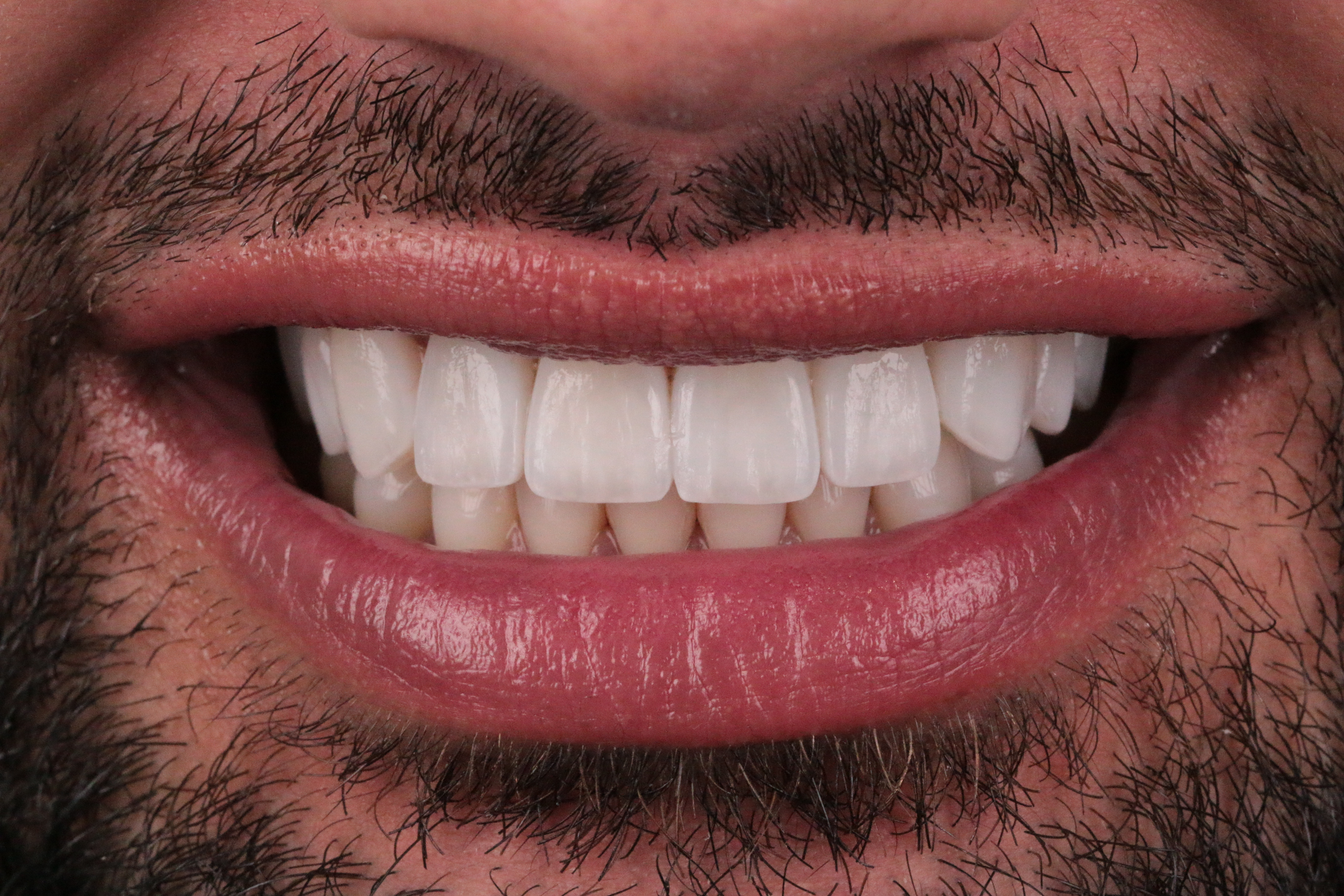 PPC Composite