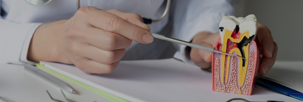 What Is a Root Canal Treatment? Dental Infection Causes, Symptoms, and Treatment Explained