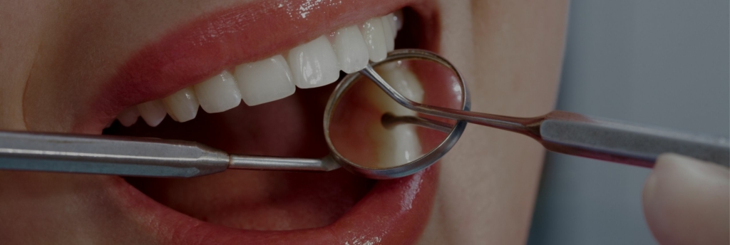 Why Should You Visit a Dental Hygienist? The Top 6 Benefits