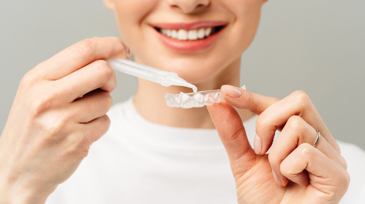 A young woman does a home teeth whitening procedure. Whitening tray with gel.