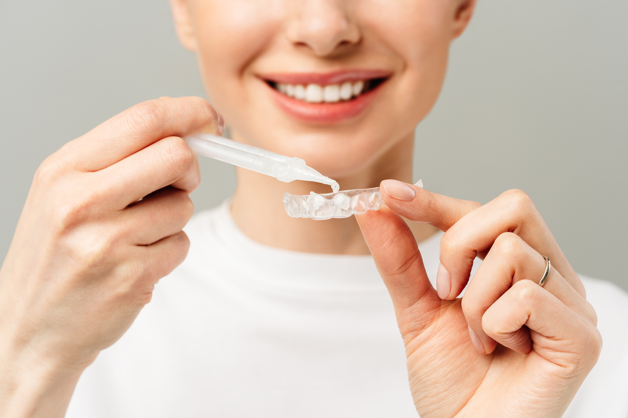 A young woman does a home teeth whitening procedure. Whitening tray with gel.